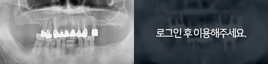 썸네일1-전후사진1