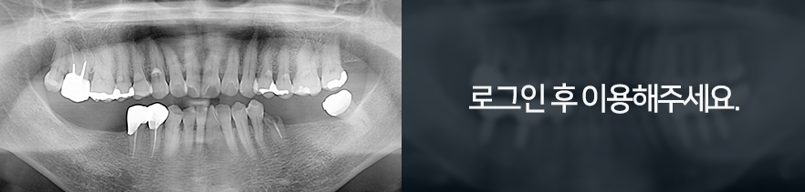 썸네일4-전후사진4