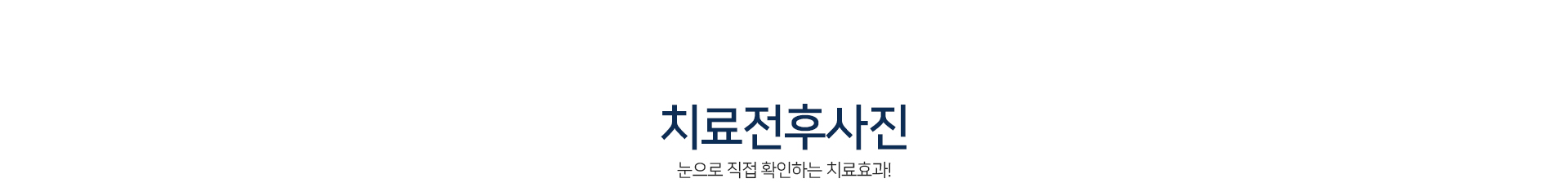 치료전후사진-눈으로-직접-확인하는-치료효과