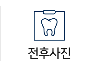 전후사진