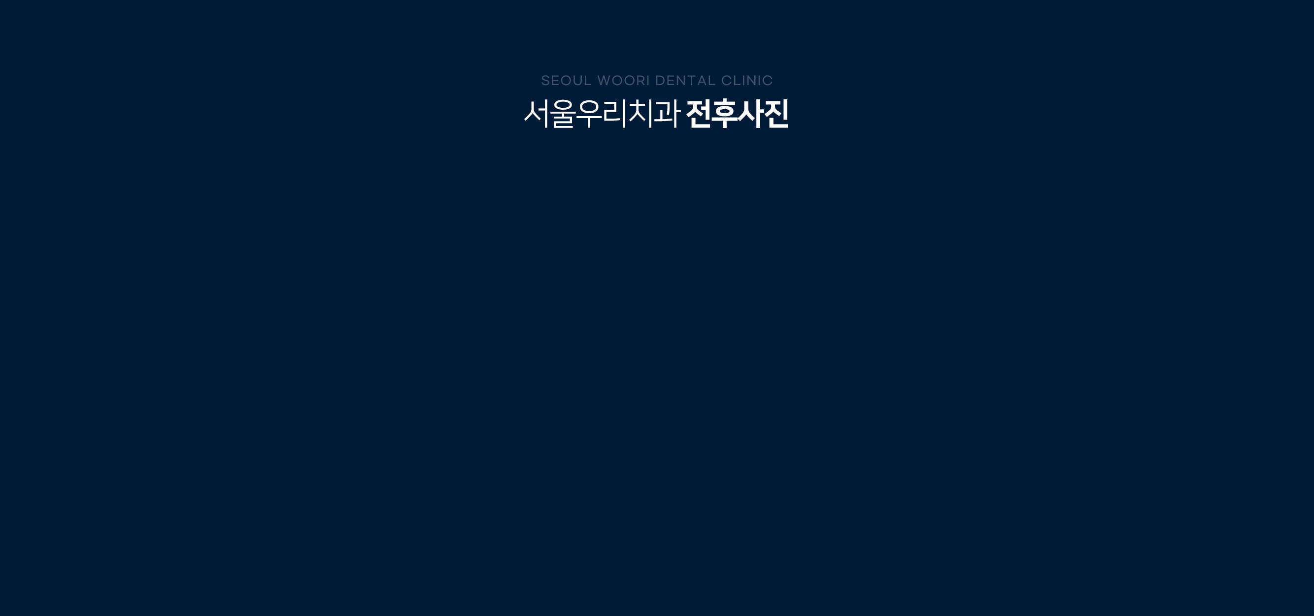 서울우리치과-전후사진