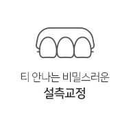 설측교정