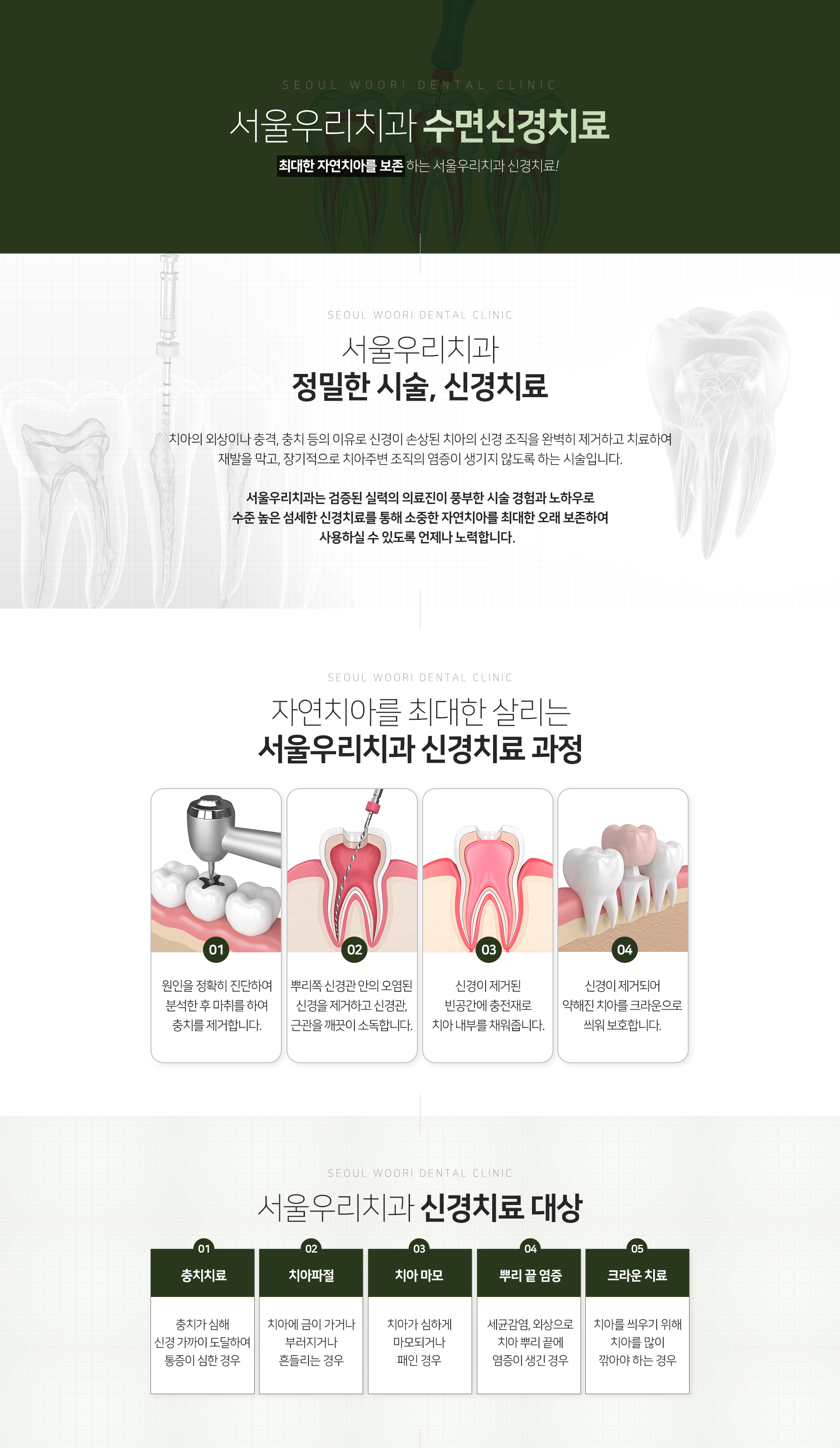 서울우리치과-수면-신경치료-치아의-외상이나-충격-충치-등의-이유로-신경이-손상된-치아의-신경-조직을-완벽히-제거하고-치료하여-재발을-막고-장기적으로-치아-주변-조직에-염증이-생기지-않도록-하는-시술입니다-신경치료-과정-1단계-원인을-정확히-진단하여-분석한-후-마취를-하여-충치를-제거합니다-2단계-뿌리-쪽-신경관-안의-오염된-신경을-제거하고-신경관-근관을-깨끗이-소독합니다-3단계-신경이-제거된-빈-공간에-충전재로-치아-내부를-채워줍니다-4단계-신경이-제거되어-약해진-치아를-크라운으로-씌워-보호합니다-신경치료-대상-충치가-심해-신경-가까이-도달하여-통증이-심한-경우-치아에-금이-가거나-부러지거나-흔들리는-경우-치아가-심하게-마모되거나-패인-경우-세균감염-외상으로-치아-뿌리-끝에-염증이-생긴-경우-치아를-씌우기-위해-치아를-많이-깎아야-하는-경우