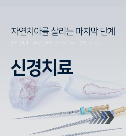자연치아를-살리는-마지막-단계-신경치료