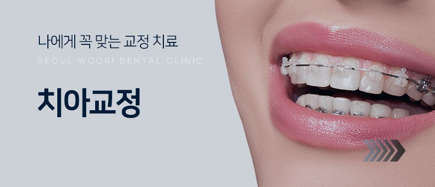 나에게-꼭-맞는-교정-치료-치아교정