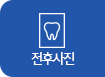 전후사진